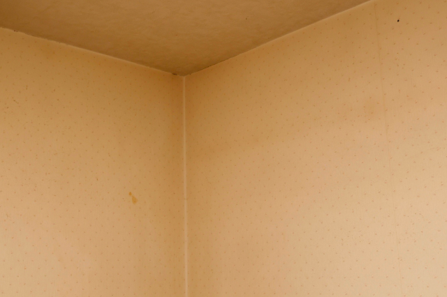 黄ばみや黒ずみ